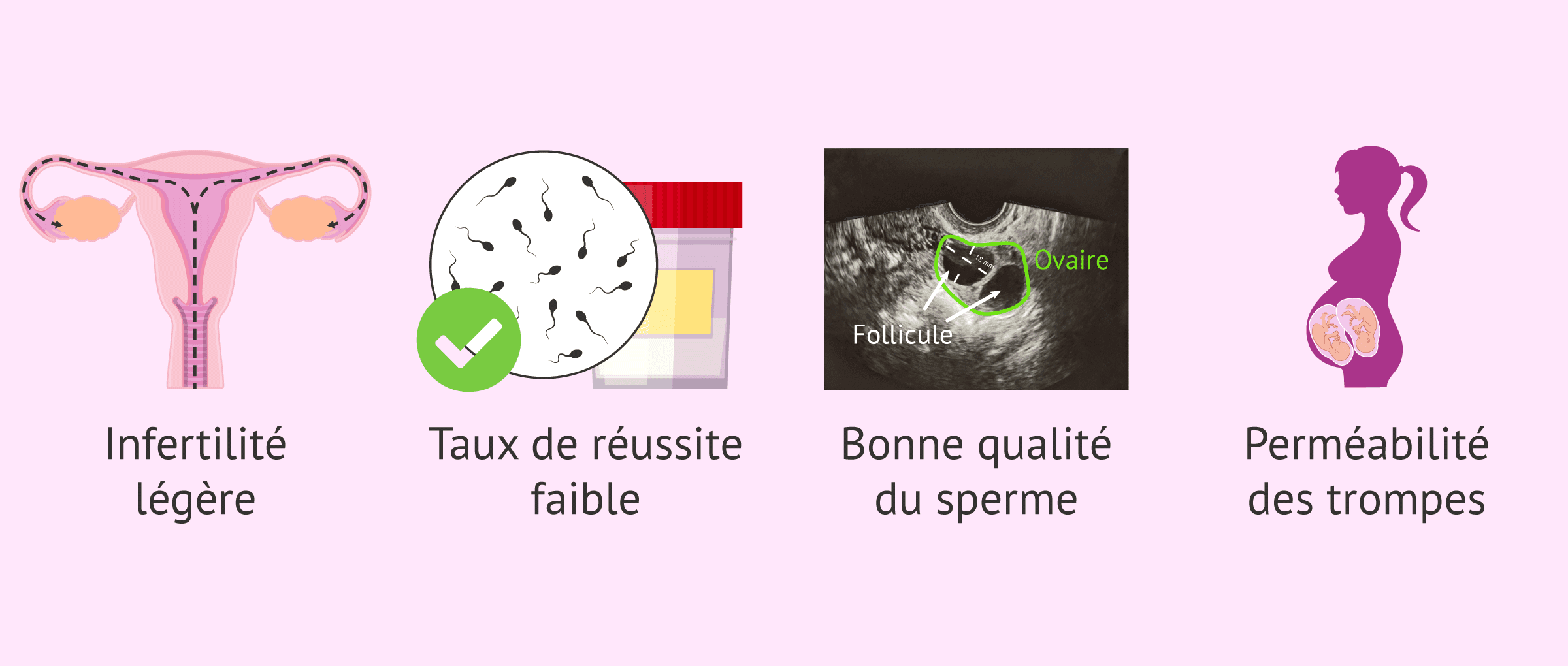 Imagen: Indications et inconvénients des rapports sexuels programmés