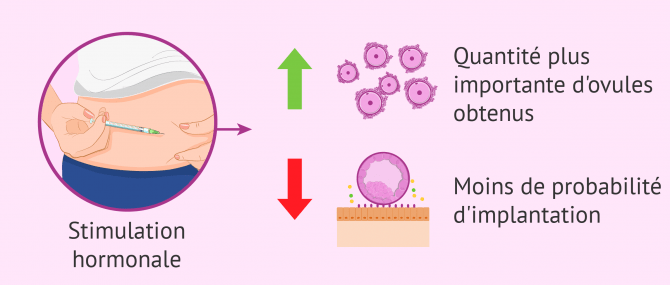 La stimulation hormonale affecte la qualité de l'endomètre