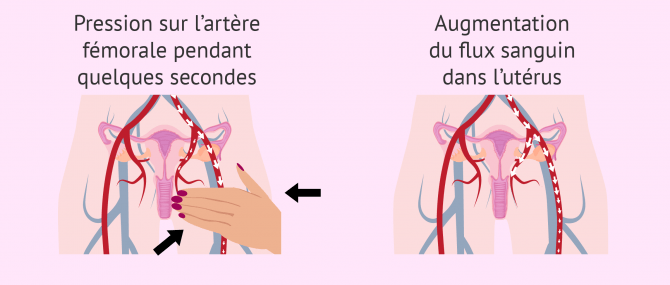Massage fémoral
