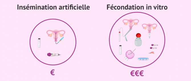 Pourquoi la FIV est plus chère que l'IA?