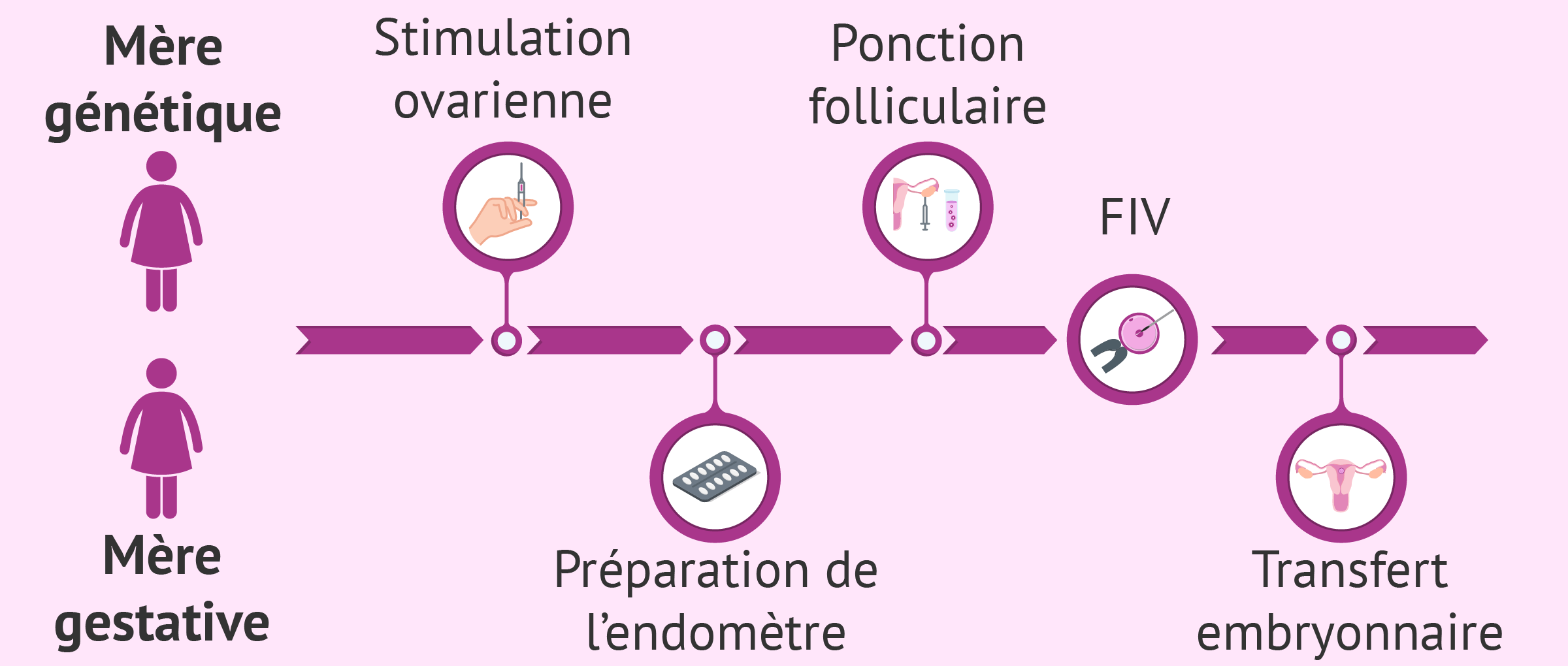 Imagen: Processus de la méthode ROPA (réception des ovocytes de la partenaire)
