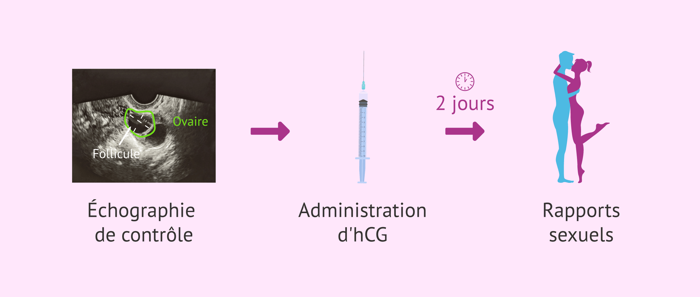 Imagen: Protocole de rapports dirigés avec induction de l'ovulation