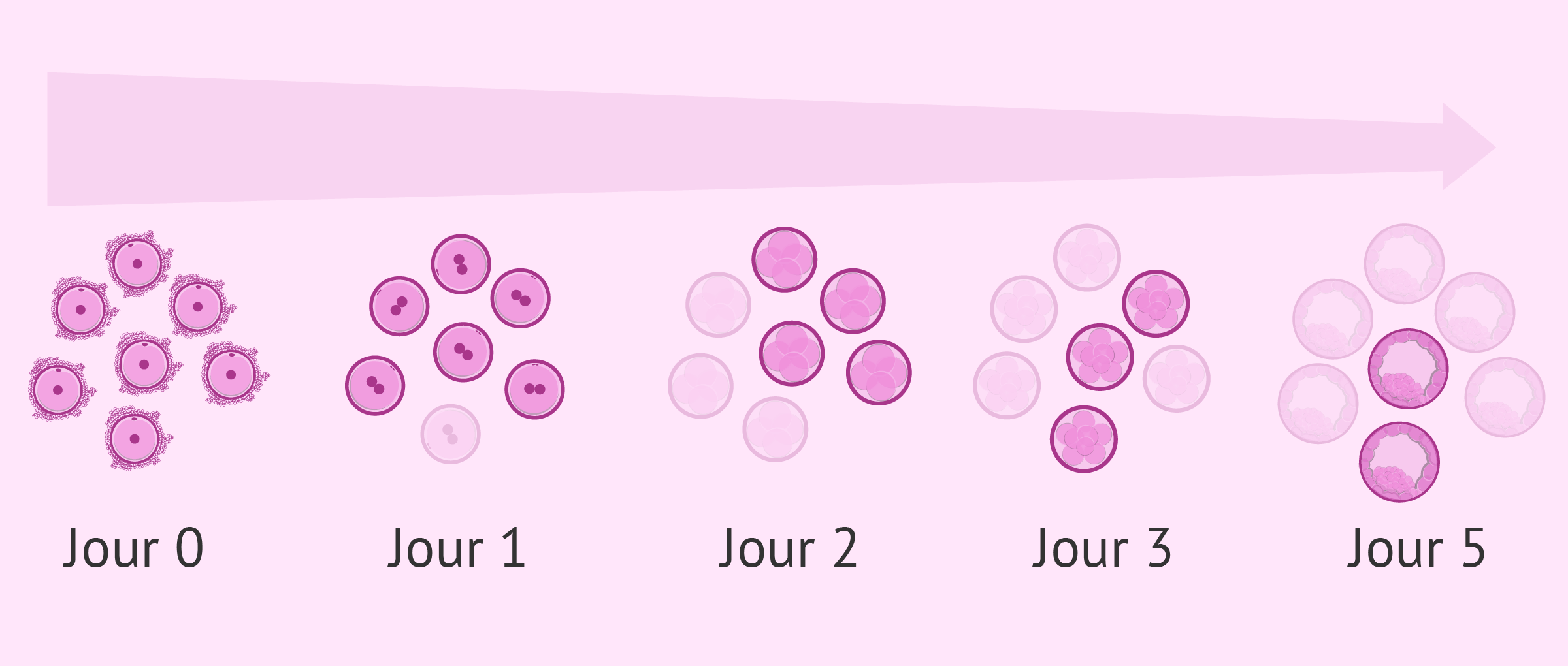 Transfert de blastocyste à J5: la FIV a-t-elle plus de succès?
