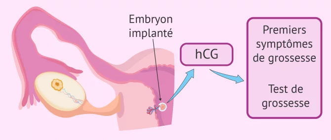 Symptômes de la nidation et hormone hCG
