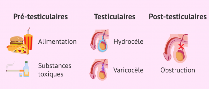 Causes qui provoquent l'oligospermie chez l'homme