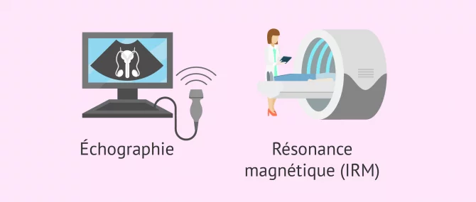 Imagen: Diagnostic de la cryptorchidie par échographie et IRM