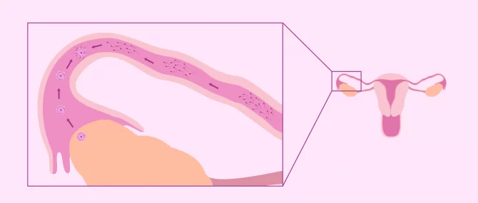 Imagen: Fécondation naturelle des trompes de Fallope