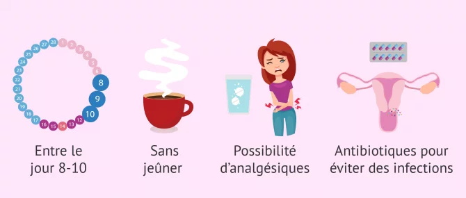 Imagen: Recommandations pour se rendre a une hystérosalpingographie