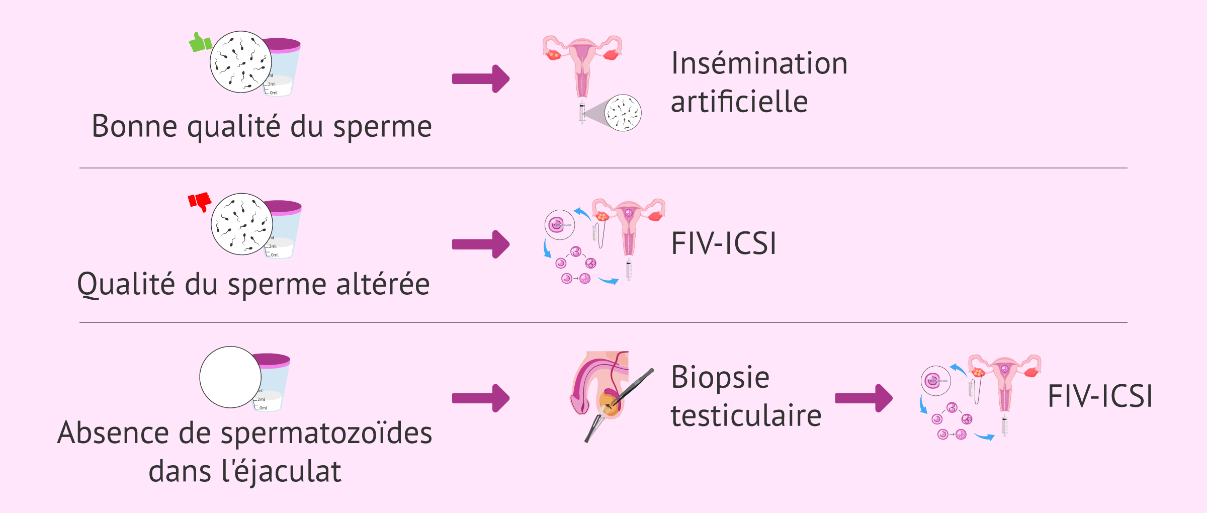 Imagen: Traitements de fertilité chez les hommes ayant des problèmes spermatiques