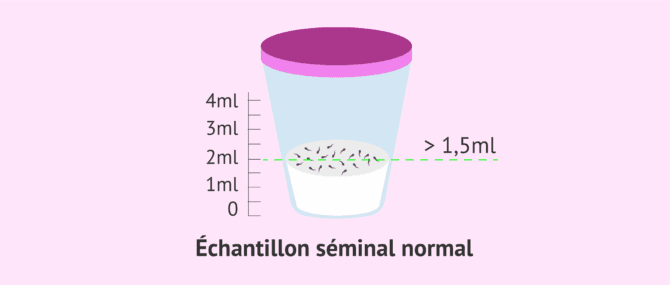 Imagen: Étude du volume éjaculé