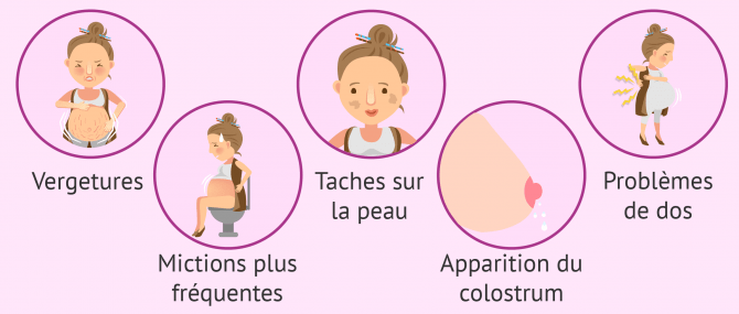 Symptômes de grossesse au sixième mois