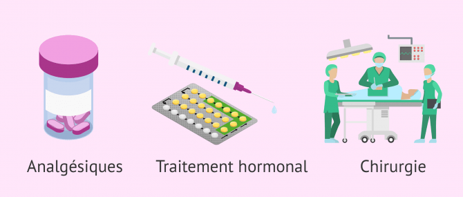 Imagen: traitement contre la douleur de l endometriose