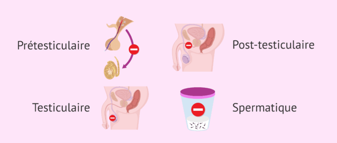 Imagen: Causes de l'infertilité chez l'homme