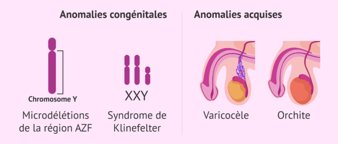 Imagen: Causes testiculaires de l'infertilité chez l'homme