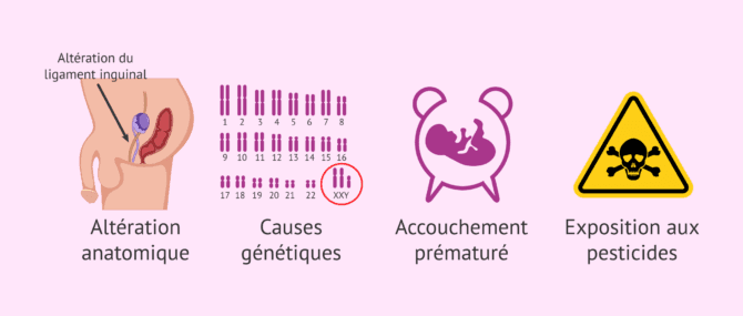 Imagen: Causes possibles de la cryptorchidie