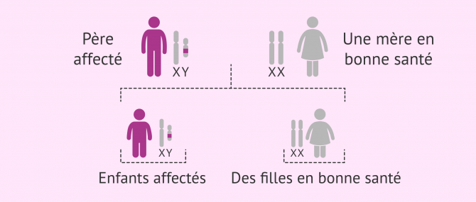 Imagen: Hérédité des maladies liées à l'axe Y