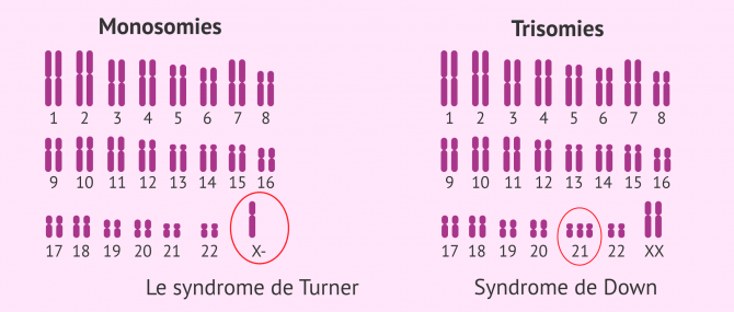Imagen: Types d'aneuploïdie compatibles avec la vie