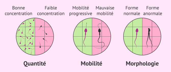 Imagen: Le facteur spermatique dans l'infertilité masculine