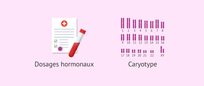 Imagen: Tests diagnostiques pour la cryptorchidie bilatérale
