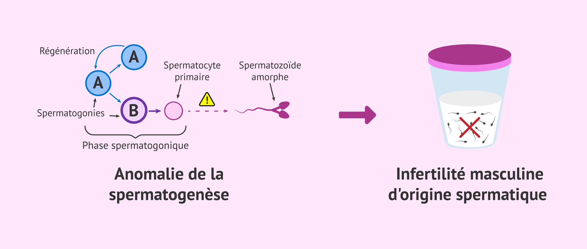 Imagen: Une erreur dans la spermatogenèse cause l'infertilité masculine