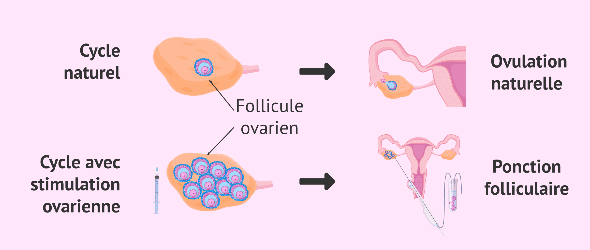 Imagen: Cycle naturel et cycle stimulé chez la femme