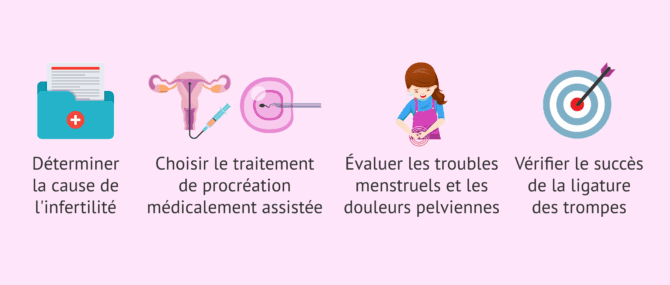 Imagen: Dans quelles situations l'hystérosalpingographie est-elle réalisée?