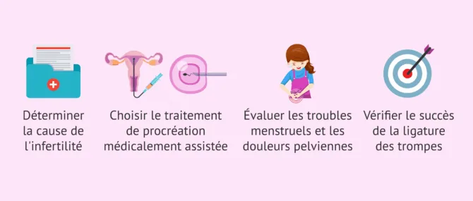Imagen: Dans quelles situations l'hystérosalpingographie est-elle réalisée?