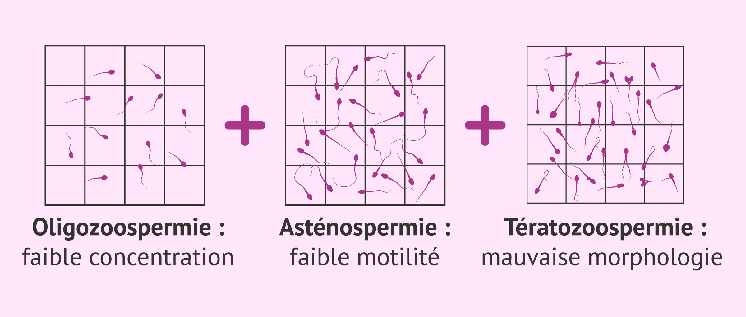 Imagen: Définition de l'oligoasthénotératozoospermie