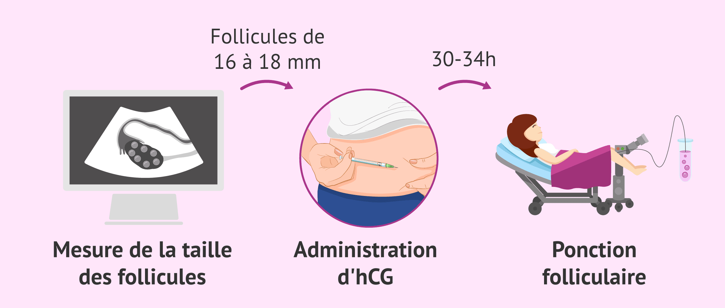 Imagen: Contrôle de la stimulation et programmation de la ponction ovarienne