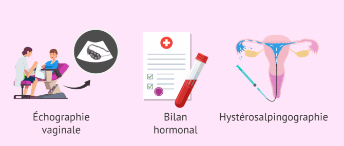 Imagen: Premiers examens de fertilité chez la femme