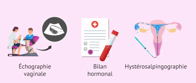 Imagen: Premiers examens de fertilité chez la femme