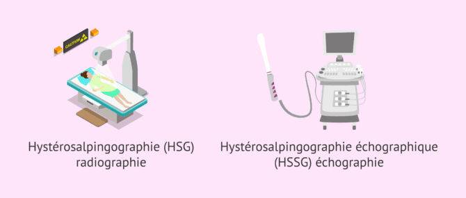 Imagen: Types d'hystérosalpingographie ou HSG
