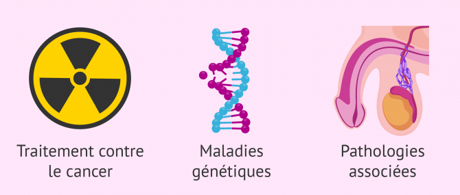 Imagen: Causes possibles irreversibles de teraospermie