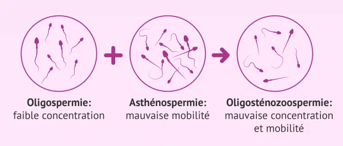 Imagen: oligoastenozoospermie