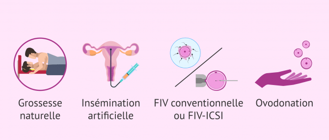 Imagen: Possibilité de grossesse en cas d'endométriose