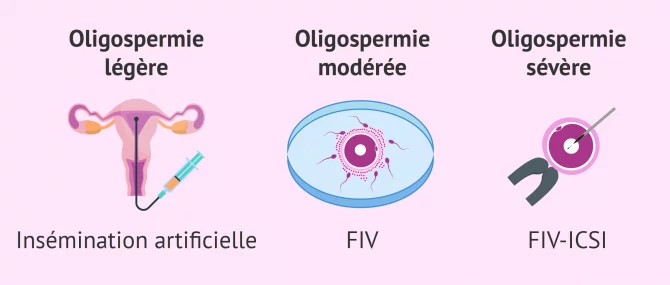 Imagen: traitement oligospermie selon degre
