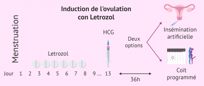 Imagen: Traitement SOPK letrozol