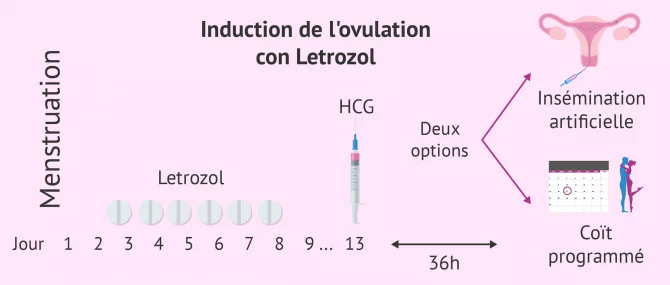 Imagen: Traitement SOPK letrozol