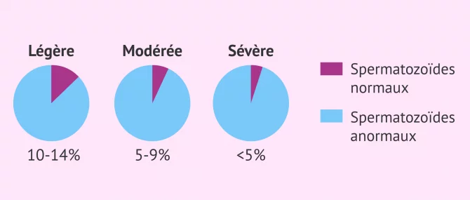Imagen: Types tératozoospermie