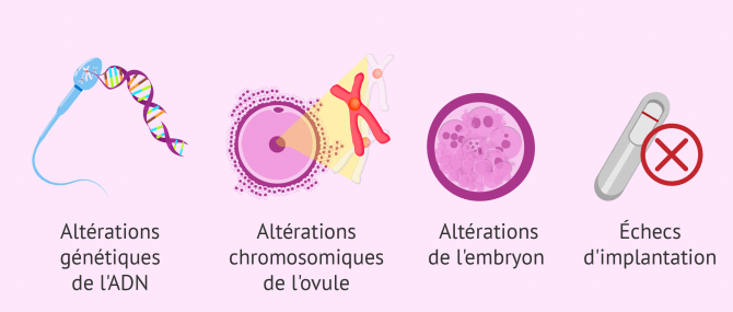 causes stérilité idiopathique