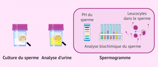 Imagen: Analyse infection sperme