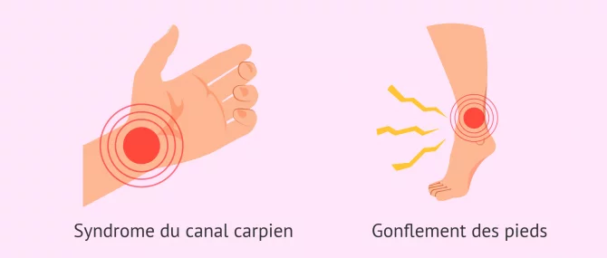 Imagen: Douleurs communes 9ème mois