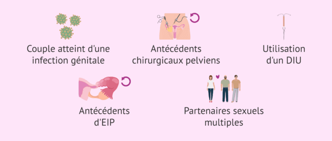 Imagen: Quels sont les facteurs de risque de la salpingite?