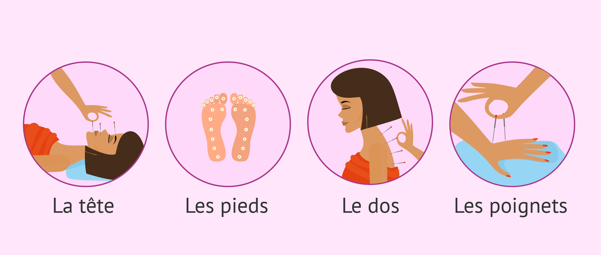 Imagen: Points acupuncture