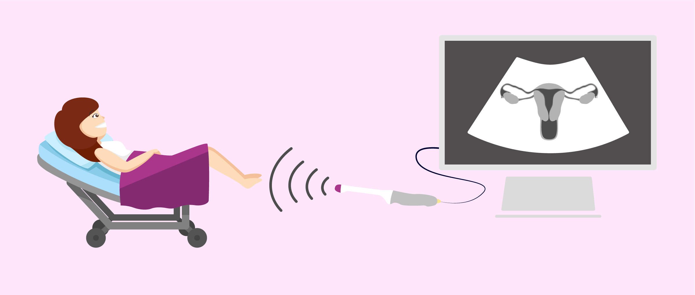 Imagen: Échographie transvaginale