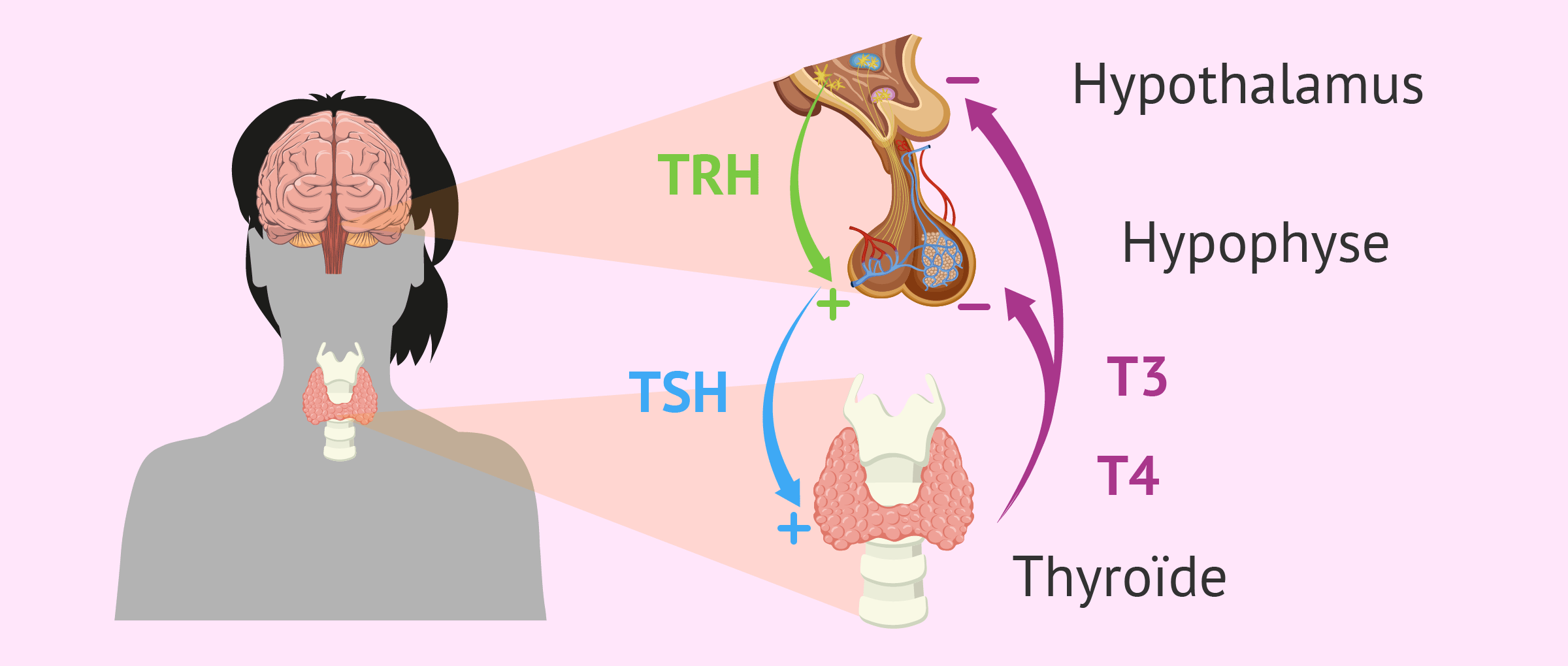 Stérilité due à la glande thyroïde