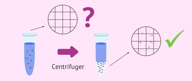Imagen: diagnostic cryptozoospermie