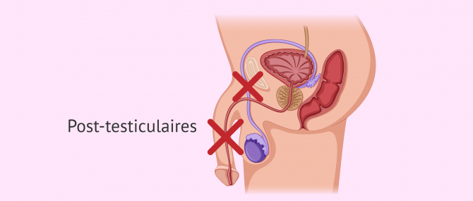 Imagen: Post-testiculaire