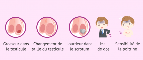 Testacies Symptômes du cancer du testicule