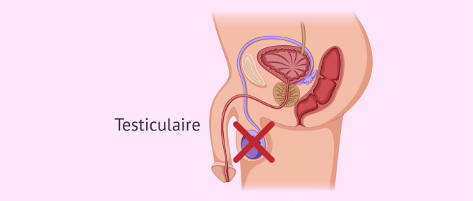 Imagen: Testiculaire